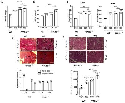 Downregulation of PTEN Promotes Autophagy via Concurrent Reduction in Apoptosis in Cardiac Hypertrophy in PPAR α−/− Mice